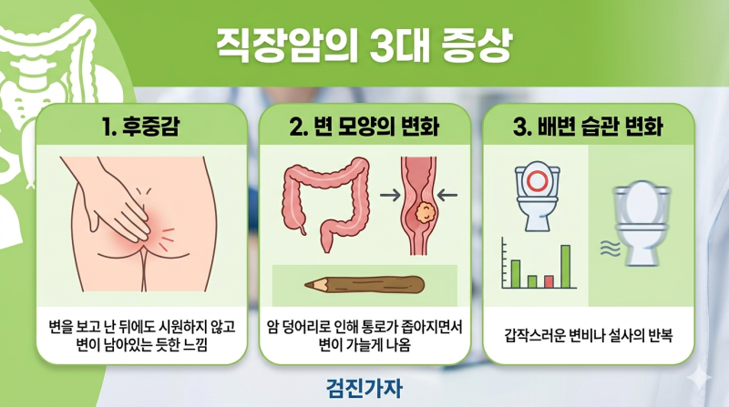 단순 변비인 줄 알았는데 직장암 항문을 지키기 위한 골든타임